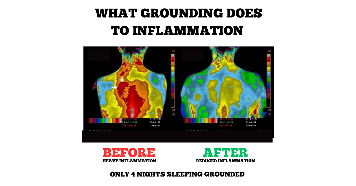 Earthing Grounding Sleep Mat - Enhanced Sleep Quality