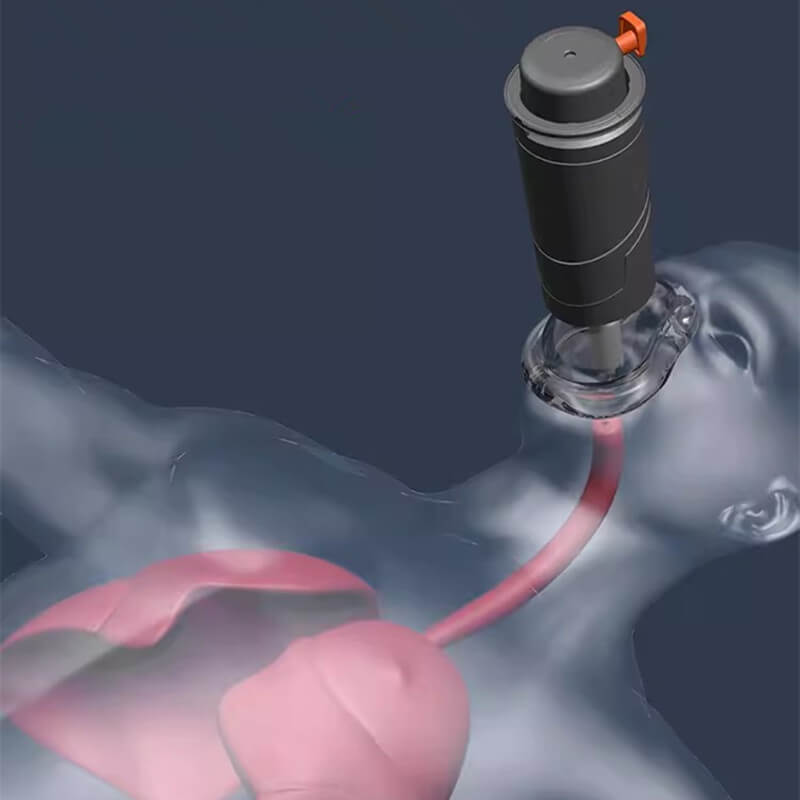 Automatic Rescue Device with Quick-Release Function – Effective Rescue Tool for Home and Travel
