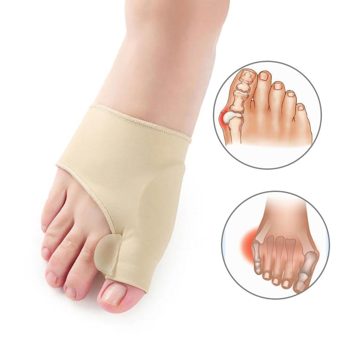 Bella Bunion Orthopedic Corrector Sleeve