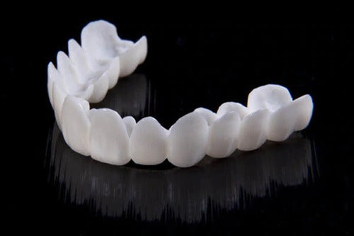 Bella | DentAlign Dental Veneers – Natural Fit and Comfort