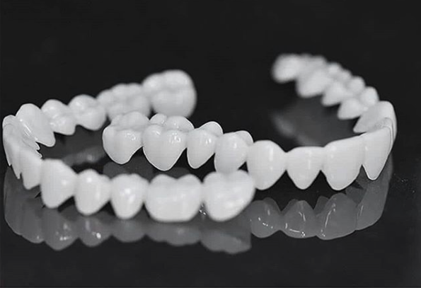 Bella | DentAlign Dental Veneers – Natural Fit and Comfort