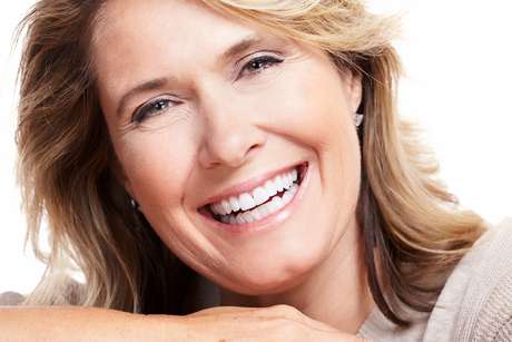 Bella | DentAlign Dental Veneers – Natural Fit and Comfort