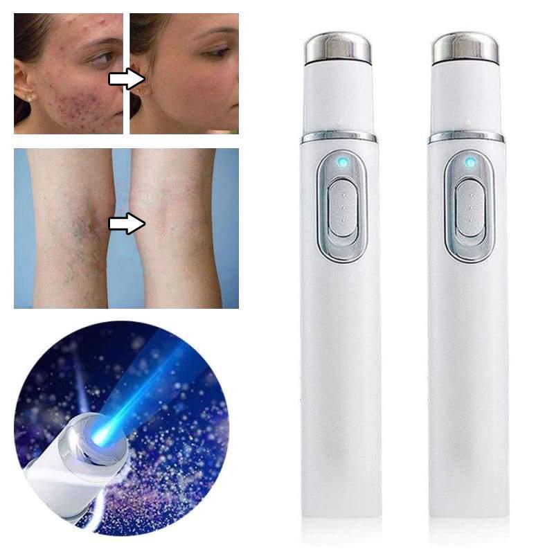 Blue Light Laser Therapy Pen for Unwanted Acne Removal