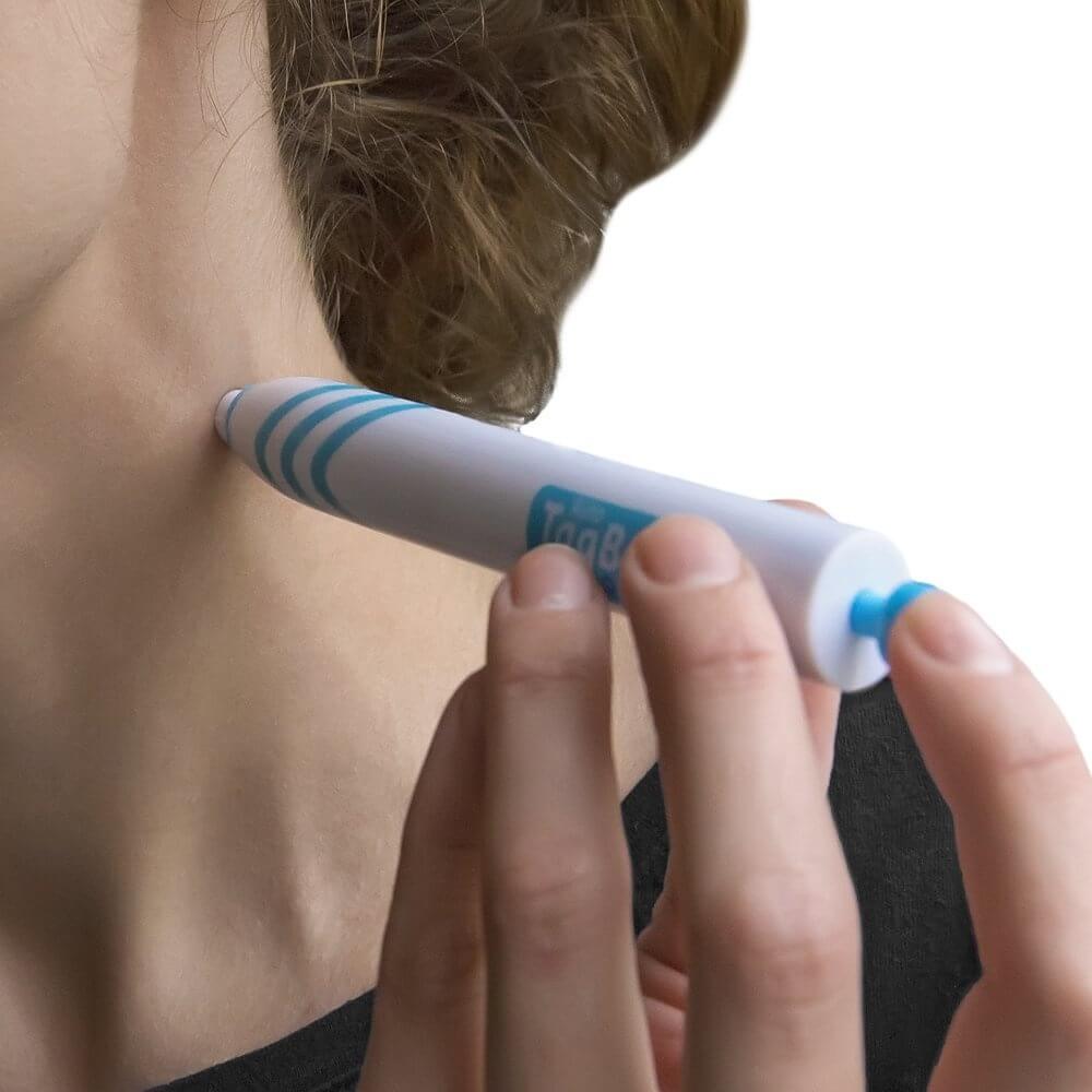 Effective Skin Tag Removal Kit