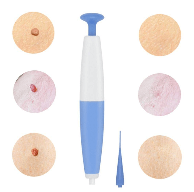 Effective Skin Tag Removal Kit