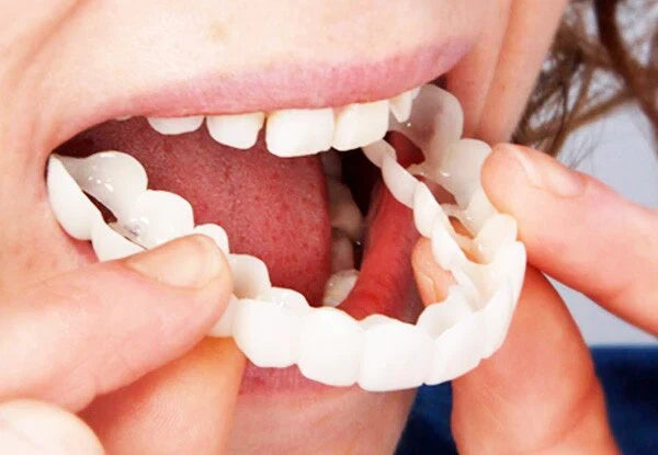 FitFlex Snap-On Denture