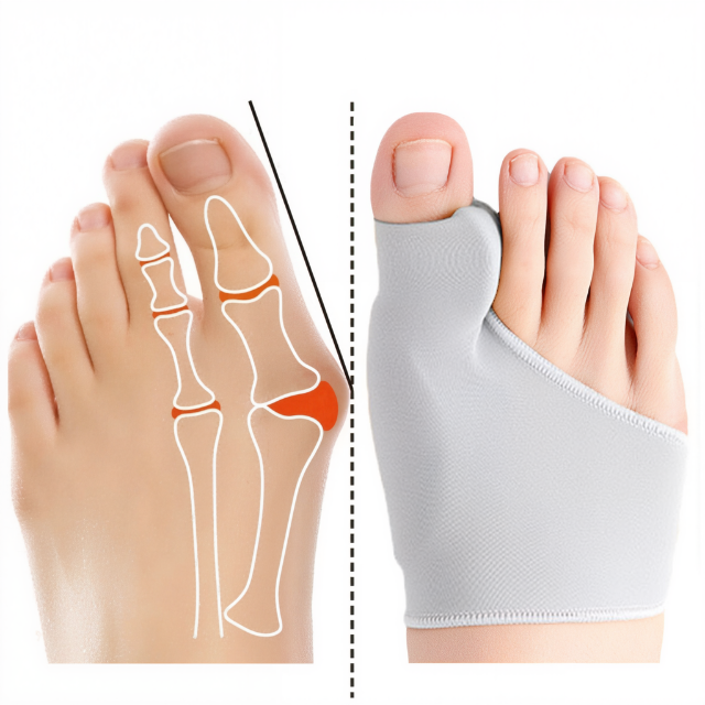 Gel Bunion Corrector with Cushioning – Discreet and Comfortable, Ideal for Everyday Wear