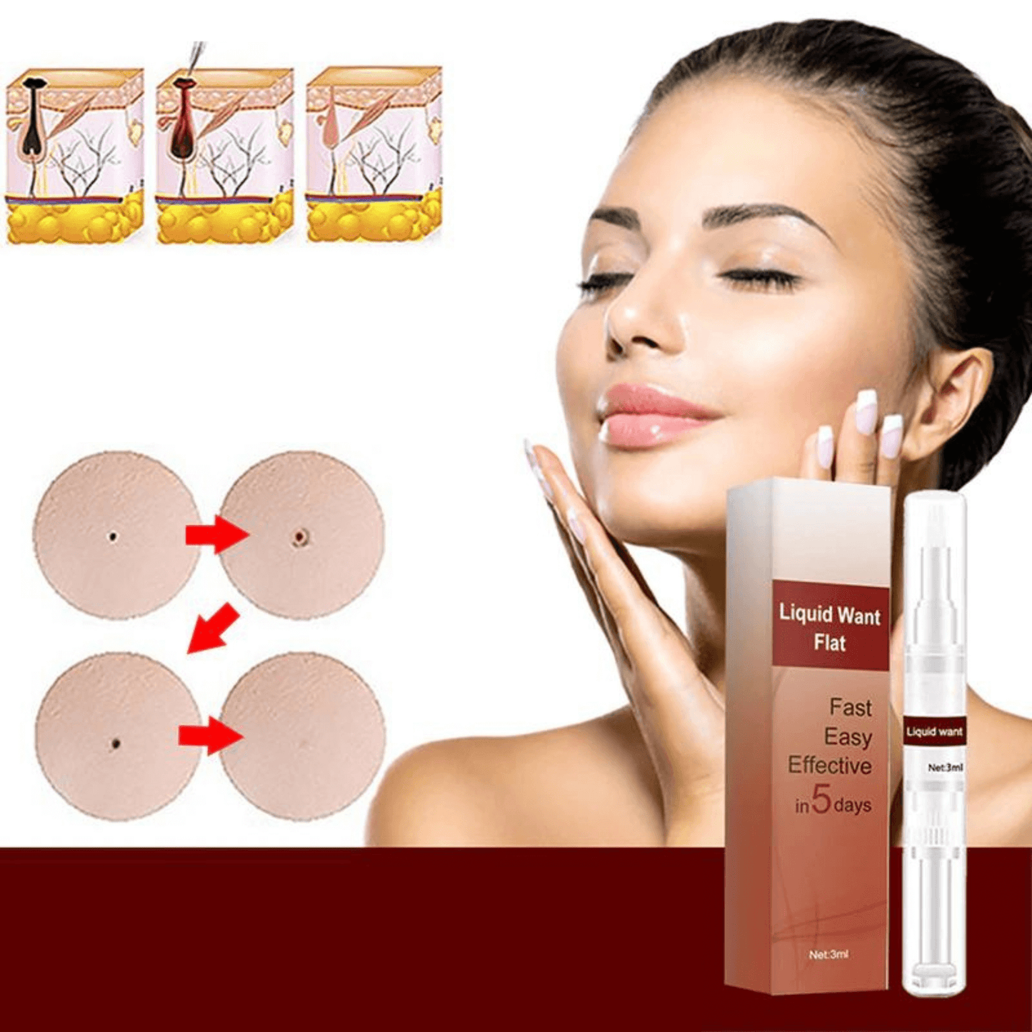 Skin Tag Remover