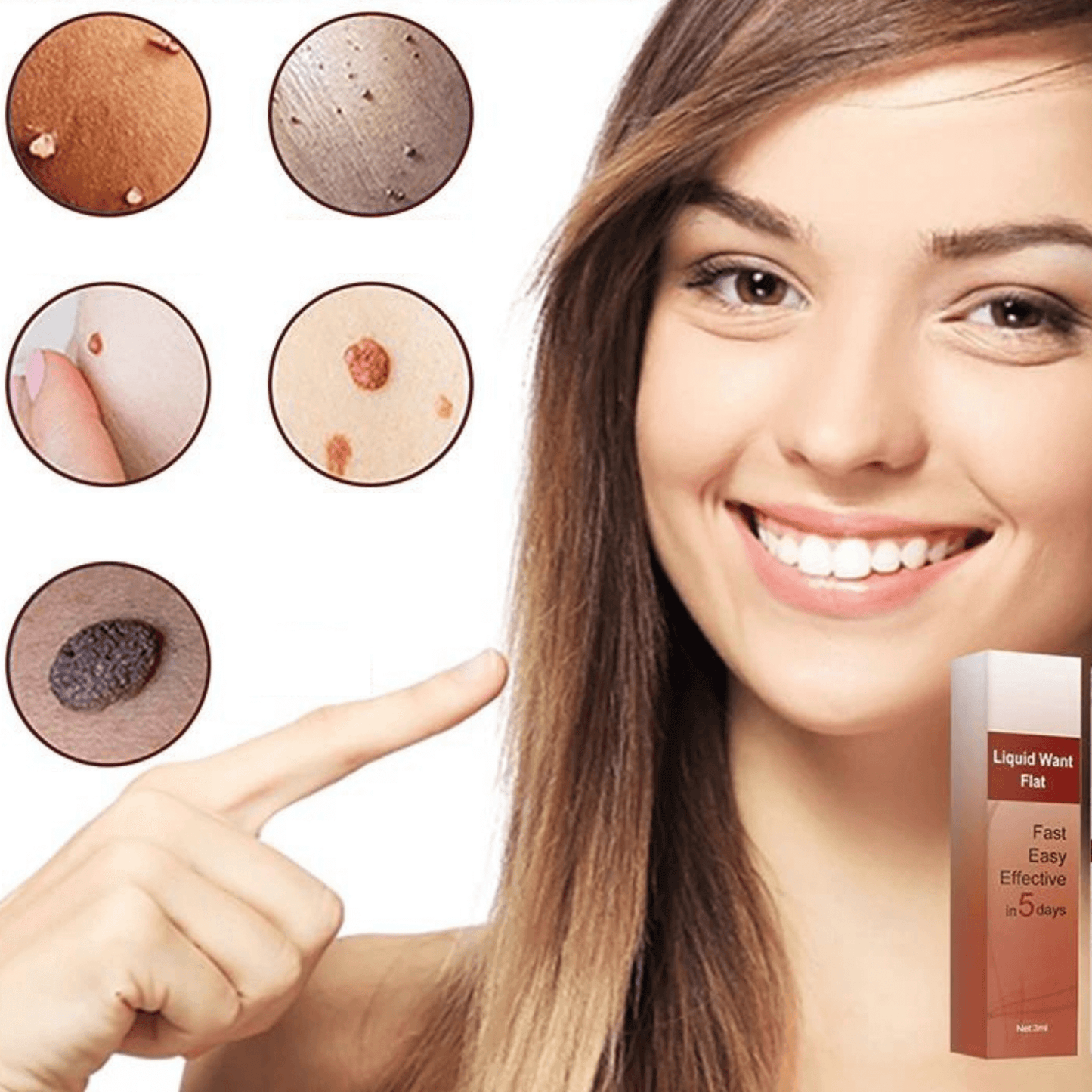 Skin Tag Remover