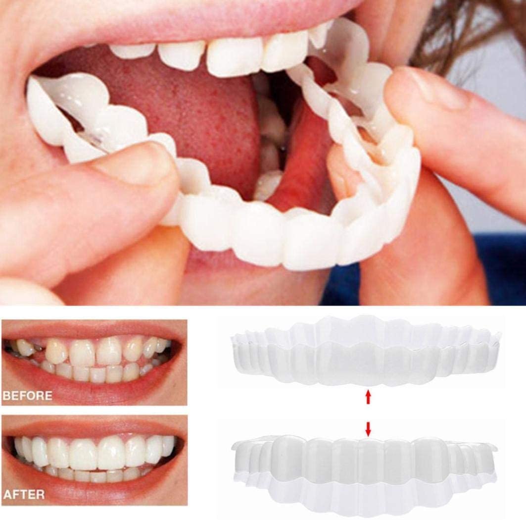 Smile Veneers for Perfect Teeth - Upper and Lower Included