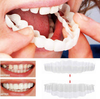 Smile Veneers for Perfect Teeth - Upper and Lower Included