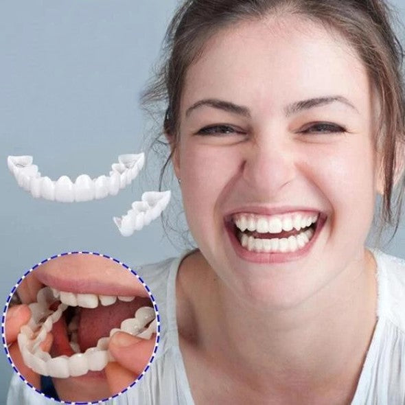 Smile Veneers for Perfect Teeth - Upper and Lower Included