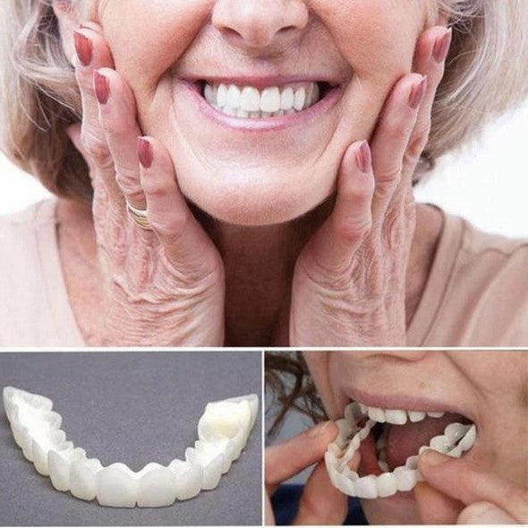 Smile Veneers for Perfect Teeth - Upper and Lower Included