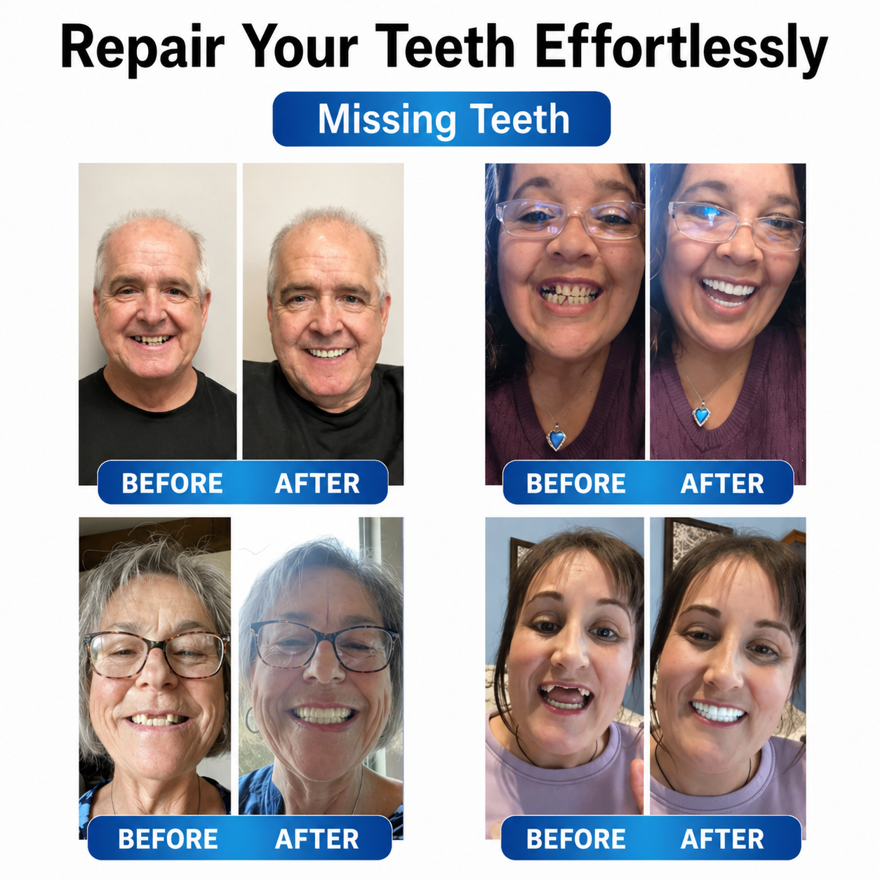 Tooth Repair Kit with LED Light - Moldable Denture Gel - Futusly Dentures