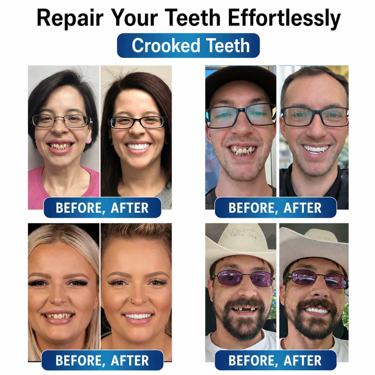 Tooth Repair Kit with LED Light - Moldable Denture Gel - Futusly Dentures