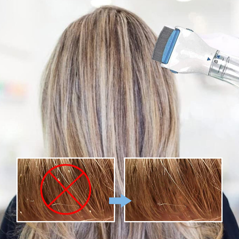 V-Comb Head Lice Machine with 3 Filters